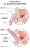 impotence treatment