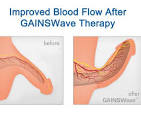 gainswave treatment